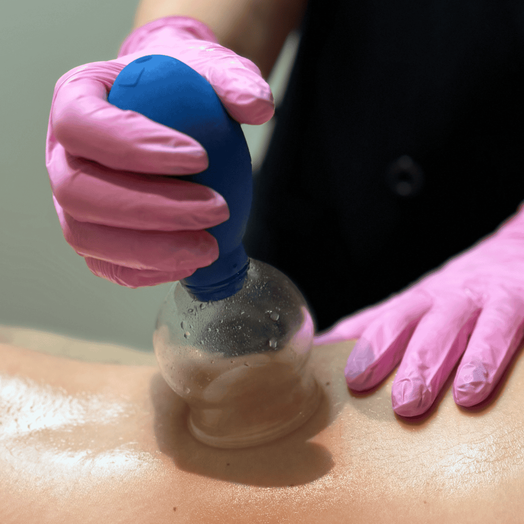 Boost jouw lichaam met cupping