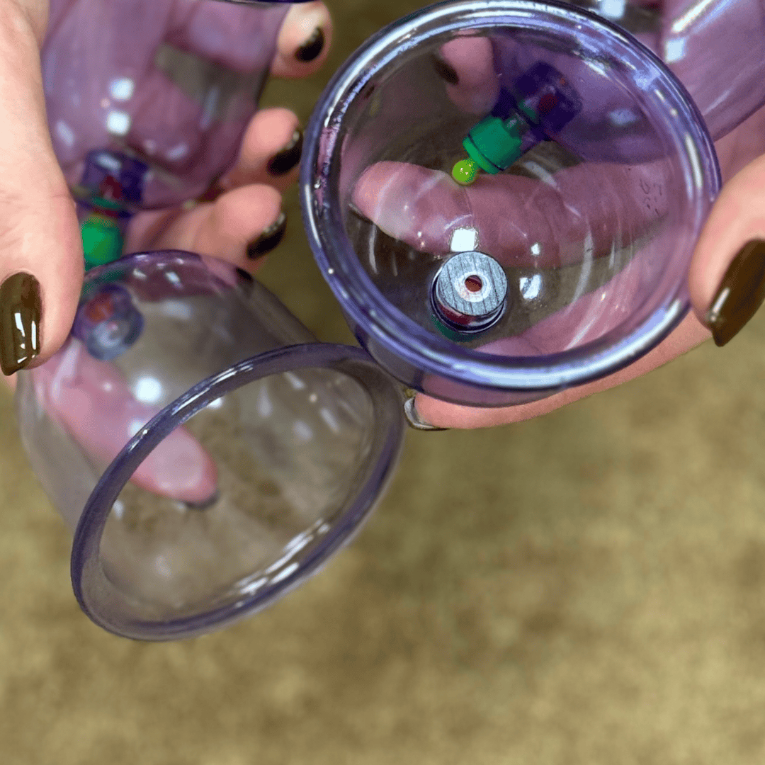 Cupping behandeling - By Rosch