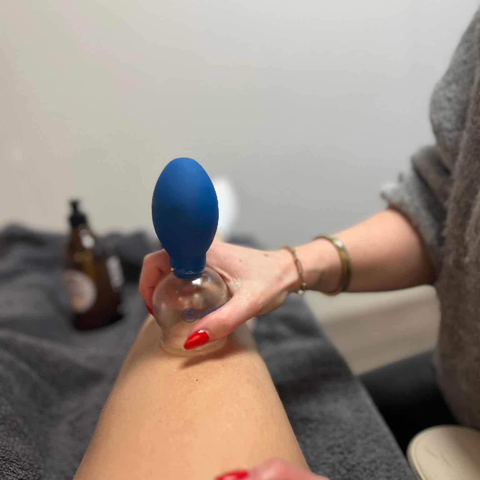 Cupping behandeling - By Rosch