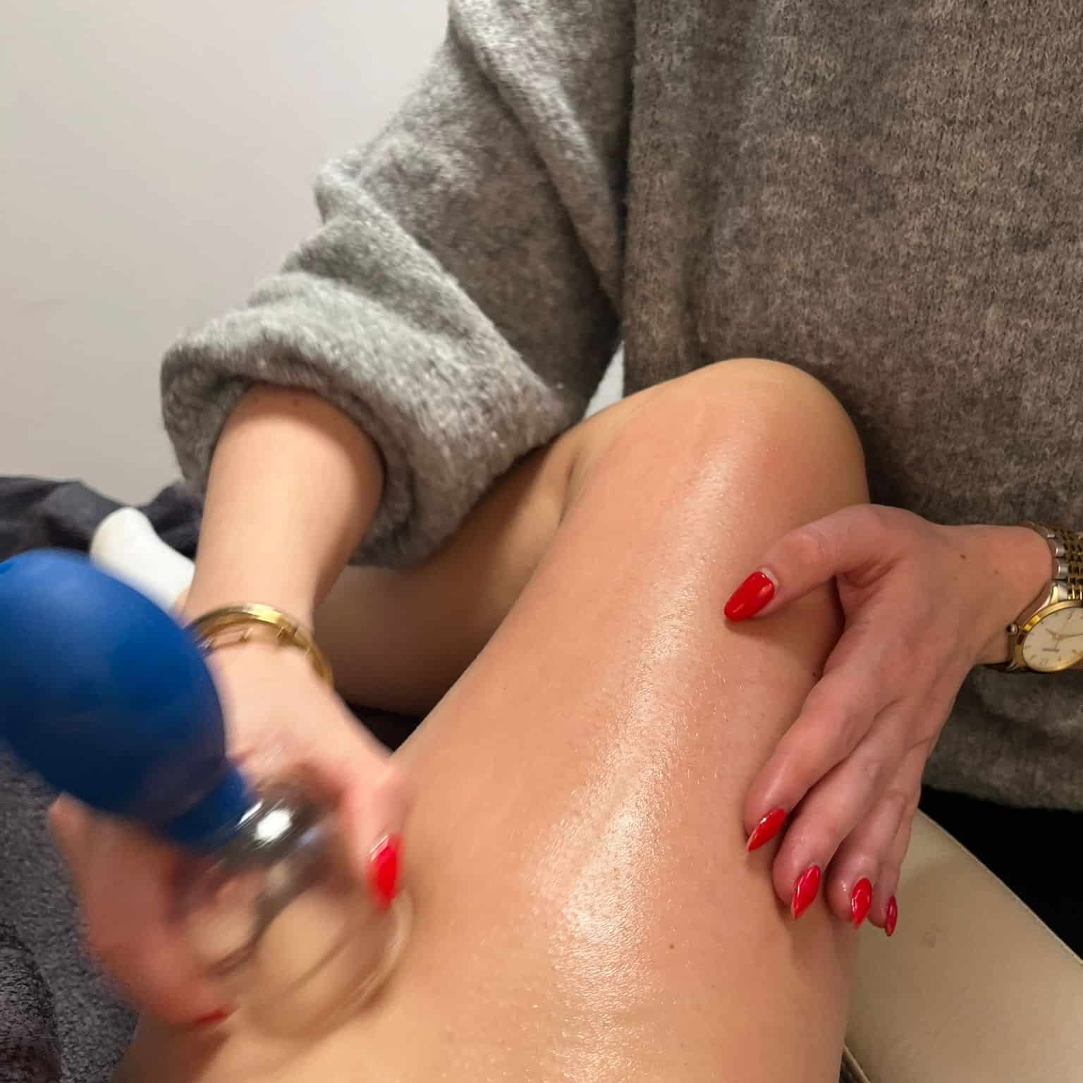 Cupping behandeling - Westland - By Rosch