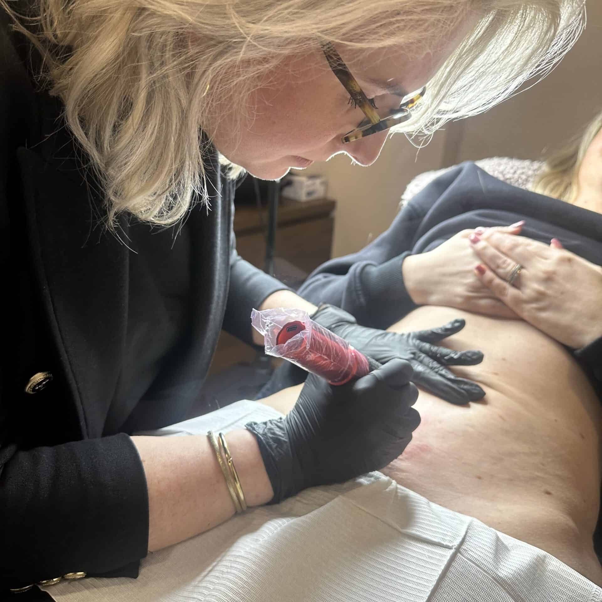 image00010 Litteken behandeling